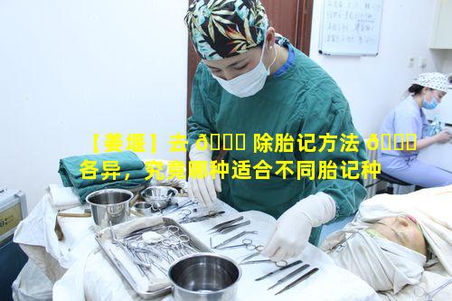 【姜堰】去 🐋 除胎记方法 🕊 各异，究竟哪种适合不同胎记种类